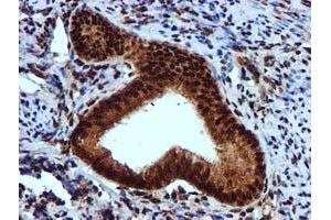 Image no. 9 for anti-EPM2A (Laforin) Interacting Protein 1 (EPM2AIP1) antibody (ABIN1498045) (EPM2AIP1 antibody)