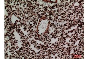 Immunohistochemistry (IHC) analysis of paraffin-embedded Mouse Lung, antibody was diluted at 1:100. (FOXP1 antibody  (C-Term))