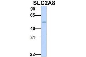 Host:  Rabbit  Target Name:  SLC2A8  Sample Type:  Human Fetal Heart  Antibody Dilution:  1. (SLC2A8 antibody  (Middle Region))