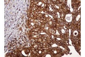 Image no. 9 for anti-B and T Lymphocyte Associated (BTLA) antibody (ABIN1496983)