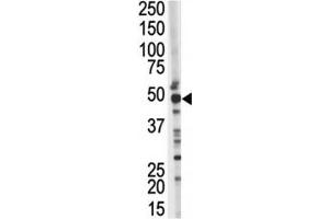 Western blot testing of TSG101 antibody and mouse kidney tissue lysate. (TSG101 antibody  (AA 1-30))