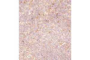 Immunohistochemistry (Paraffin-embedded Sections) (IHC (p)) image for anti-Fc Fragment of IgG, High Affinity Ib, Receptor (CD64) (FCGR1B) (AA 248-276), (C-Term) antibody (ABIN653144)