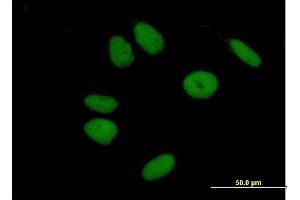 Immunofluorescence of purified MaxPab antibody to ZNF43 on HeLa cell. (ZNF43 antibody  (AA 1-803))