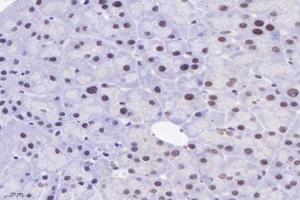 Immunohistochemistry analysis of paraffin-embedded mouse pancreas using,PPIL2 (ABIN7075005) at dilution of 1: 3600 (PPIL2 antibody)