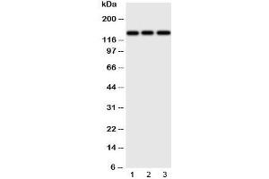 Western blot testing of ERBB4 antibody and Lane 1:  human HeLa;  2: (h) U87;  3: mouse Neuro-2a cell lysate.