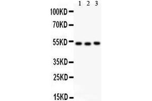 Anti- Factor VII antibody, Western blotting All lanes: Anti Factor VII  at 0. (Factor VII antibody  (C-Term))