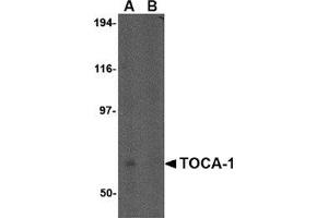 Western blot analysis of TOCA-1 in human brain tissue lysate in (A) the absence and (B) the presence of blocking peptide with this product at 0. (FNBP1L antibody  (N-Term))