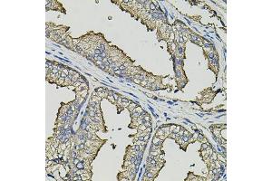 Immunohistochemistry of paraffin-embedded human prostate using SMN2 antibody (ABIN5974442) (40x lens). (SMN2 antibody)