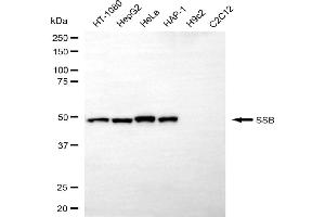 Western blotting analysis using SSB antibody (ABIN7800359).