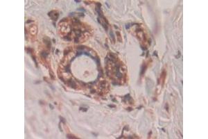 Figure. (AIMP1 antibody  (AA 148-312))