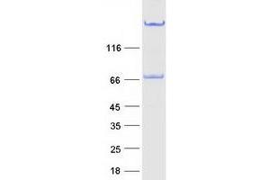 Western Blotting (WB) image for Golgi Membrane Protein 1 (GOLM1) (Transcript Variant 2) protein (Myc-DYKDDDDK Tag) (ABIN2722135)