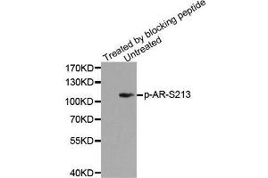 Western blot analysis of extracts from DU145 cells using Phospho-AR-S213 antibody. (Androgen Receptor antibody  (pSer213))