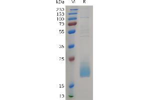 Human CD3D Protein, His Tag on SDS-PAGE under reducing condition.