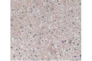 Detection of TMEM27 in Human Liver Tissue using Monoclonal Antibody to Transmembrane Protein 27 (TMEM27)