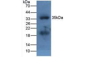 Figure. (APOA5 antibody  (AA 21-210))