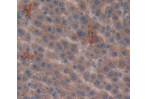 IHC-P analysis of Rat Tissue, with DAB staining. (SULT1A1 antibody  (AA 3-291))