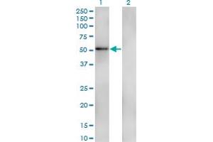 Western Blot analysis of ZNF207 expression in transfected 293T cell line by ZNF207 monoclonal antibody (M05), clone 7G1.