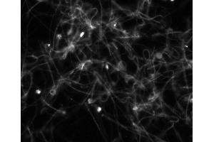 anti-Potassium Channel, Subfamily U, Member 1 (KCNU1) (AA 1052-1121) antibody