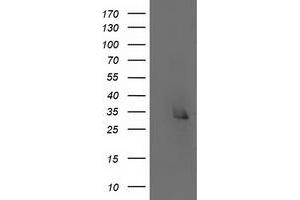 HEK293T cells were transfected with the pCMV6-ENTRY control (Left lane) or pCMV6-ENTRY ERCC1 (Right lane) cDNA for 48 hrs and lysed. (ERCC1 antibody)