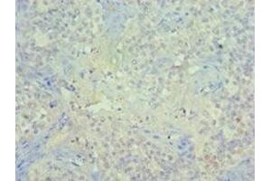 Immunohistochemistry of paraffin-embedded human tonsil tissue using ABIN7150963 at dilution of 1:100 (PIAS1 antibody  (AA 422-651))