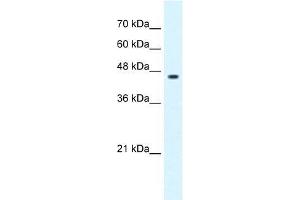 GLIS3 antibody used at 0. (GLIS3 antibody  (C-Term))