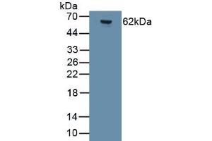 Detection of Recombinant GRIA2, Human using Monoclonal Antibody to Glutamate Receptor, Ionotropic, AMPA 2 (GRIA2) (GRIA2 antibody  (AA 413-527))