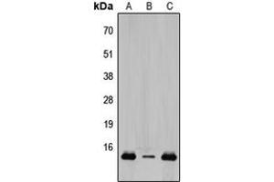 Western blot analysis of TCEAL8 expression in HeLa (A), Raw264. (TCEAL8 antibody  (Center))
