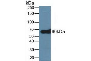 Detection of TRAF6 in Human A431 Cells using Polyclonal Antibody to TNF Receptor Associated Factor 6 (TRAF6) (TRAF6 antibody  (AA 153-423))