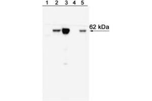 Western Blotting (WB) image for anti-T-Bet antibody (ABIN967672) (T-Bet antibody)