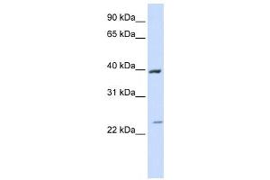 Western Blotting (WB) image for anti-Acyl-CoA Dehydrogenase, Long Chain (ACADL) antibody (ABIN2458052) (ACADL antibody)
