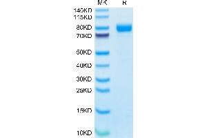 Human IL-1R3 on Tris-Bis PAGE under reduced condition. (IL1RAP Protein (AA 21-359) (Fc Tag))