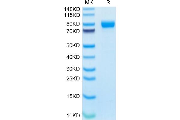 IL1RAP Protein (AA 21-359) (Fc Tag)