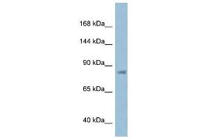 Western Blot showing KPNB1 antibody used at a concentration of 1 ug/ml against ACHN Cell Lysate (KPNB1 antibody  (N-Term))