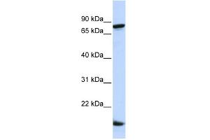 WB Suggested Anti-ZNF281 Antibody Titration:  0. (ZNF281 antibody  (Middle Region))