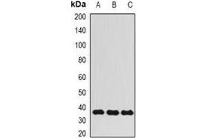 Western blot analysis of ALKBH3 expression in HepG2 (A), Hela (B), MCF7 (C) whole cell lysates.
