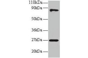 Western blot All lanes: RPL17 antibody at 2 μg/mL + EC109 whole cell lysate Secondary Goat polyclonal to rabbit IgG at 1/15000 dilution Predicted band size: 22, 18, 27 kDa Observed band size: 27, 80 kDa (RPL17 antibody  (AA 2-184))