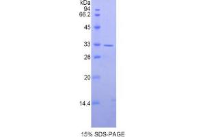 SDS-PAGE analysis of Human AXIN2 Protein.