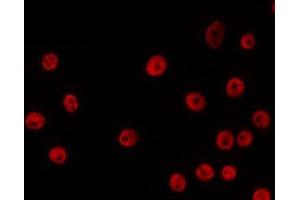 ABIN6266672 staining HeLa by IF/ICC. (USF2 antibody  (Internal Region))