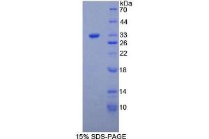SDS-PAGE analysis of Mouse COL1a1 Protein. (COL1A1 Protein)