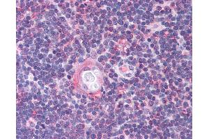 Anti-CDC25B antibody IHC of human thymus. (CDC25B antibody  (AA 56-105))