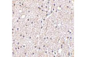 Immunohistochemistry of BRSK2 in human brain tissue with BRSK2 antibody at 5 μg/ml. (BRSK2 antibody  (C-Term))