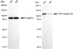 Western blotting analysis using EPH receptor B3 antibody (ABIN7798456). (Recombinant EPH Receptor B3 antibody)