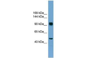 WB Suggested Anti-RB1  Antibody Titration: 0.