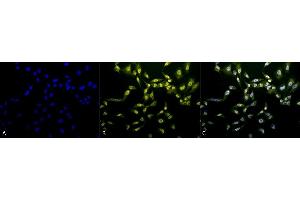 Immunocytochemistry/Immunofluorescence analysis using Rabbit Anti-Phosphothreonine Polyclonal Antibody (ABIN361757). (Phosphothreonine antibody)