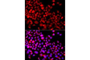 Immunofluorescence analysis of A549 cell using CALCOCO1 antibody. (CALCOCO1 antibody)