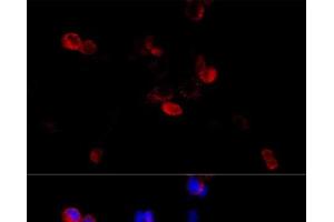 Immunofluorescence analysis of HeLa cells using FLNB Polyclonal Antibody at dilution of 1:100 (40x lens). (FLNB antibody)