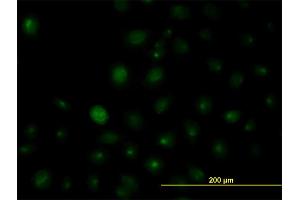 Immunofluorescence of monoclonal antibody to HNRPA2B1 on HeLa cell. (HNRNPA2B1 antibody  (AA 1-249))