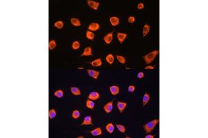 Immunofluorescence analysis of L929 cells using SCYL2 Rabbit pAb (ABIN6132636, ABIN6147463, ABIN6147465 and ABIN6217078) at dilution of 1:100. (SCYL2 antibody  (AA 1-300))