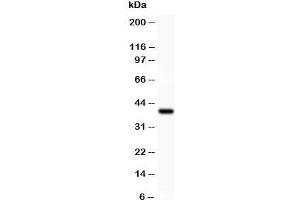 Western blot testing of IKK alpha antibody and recombinant human protein (0. (IKK alpha antibody  (AA 411-745))