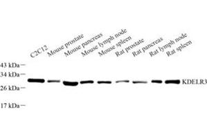 KDELR3 antibody